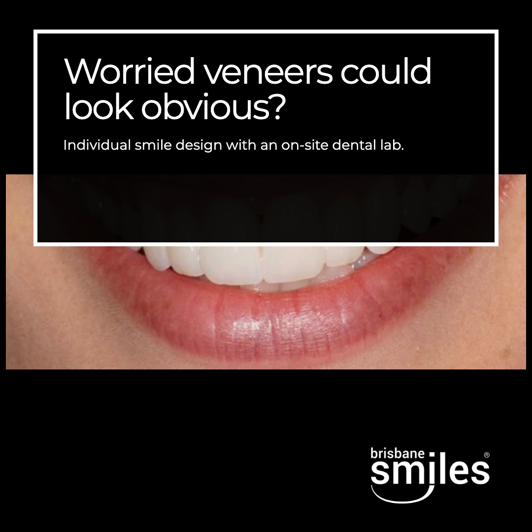 First finished Brisbane Smiles image ad