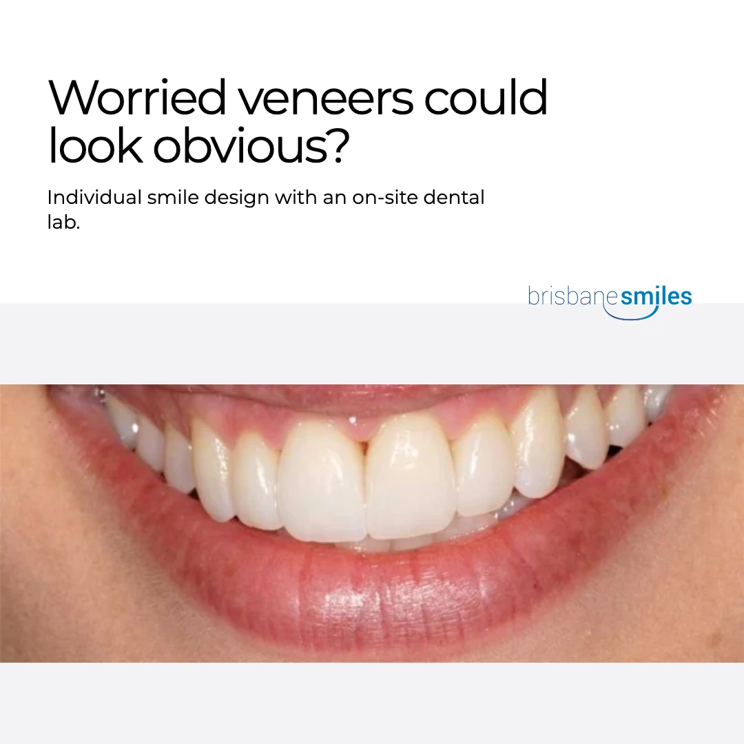 Avoid an obvious result ad creative
