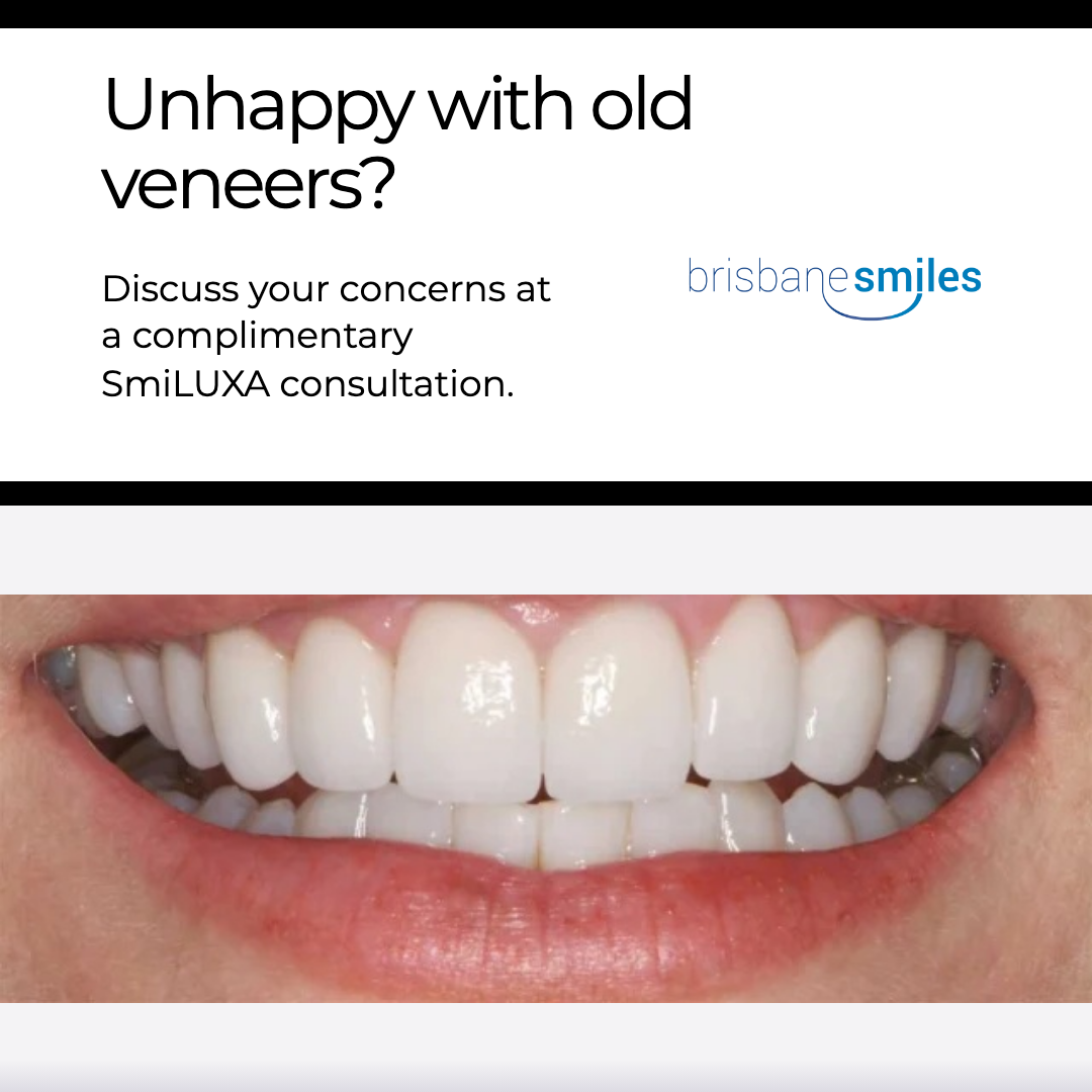 Second finished Brisbane Smiles image ad
